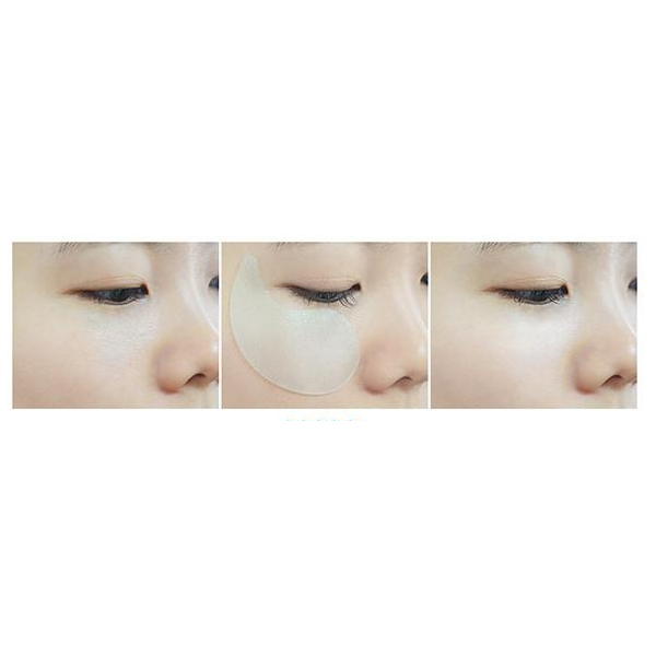 SNP Bird's Nest Aqua Eye Patch