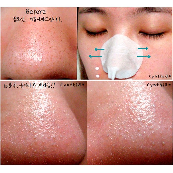 Салфетки для удаления черных точек Ciracle Blackhead Off Sheet - фото 7