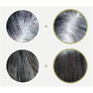 Lador Scalp Hair Helper Tonic