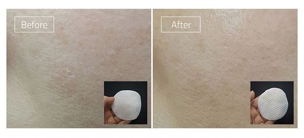 Eunyul Clean &amp; Fresh Pimple &amp; Sebum Clear Pad