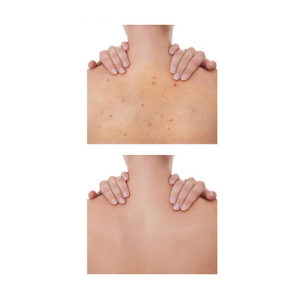 Koelf Madecassoside Clarifing Body Spray